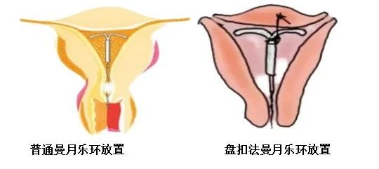 图片10.png 图片10.png