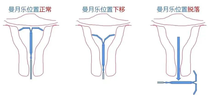 图片7.png 图片7.png