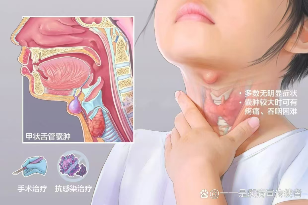 图片11.png 图片11.png